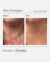 Load image into Gallery viewer, Skin Omegas 180 Capsules

