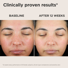 Load image into Gallery viewer, EltaMD UV Skin Recovery Red Color Correcting Green Tint Broad Spectrum SPF 50
