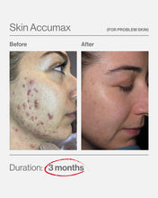 Load image into Gallery viewer, Skin Accumax® 60 Capsules
