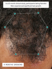 Load image into Gallery viewer, Nutrafol Men | 3 Month Supply
