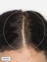 Load image into Gallery viewer, Nutrafol Women | 3 Month Supply
